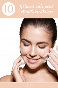astuces anti acné